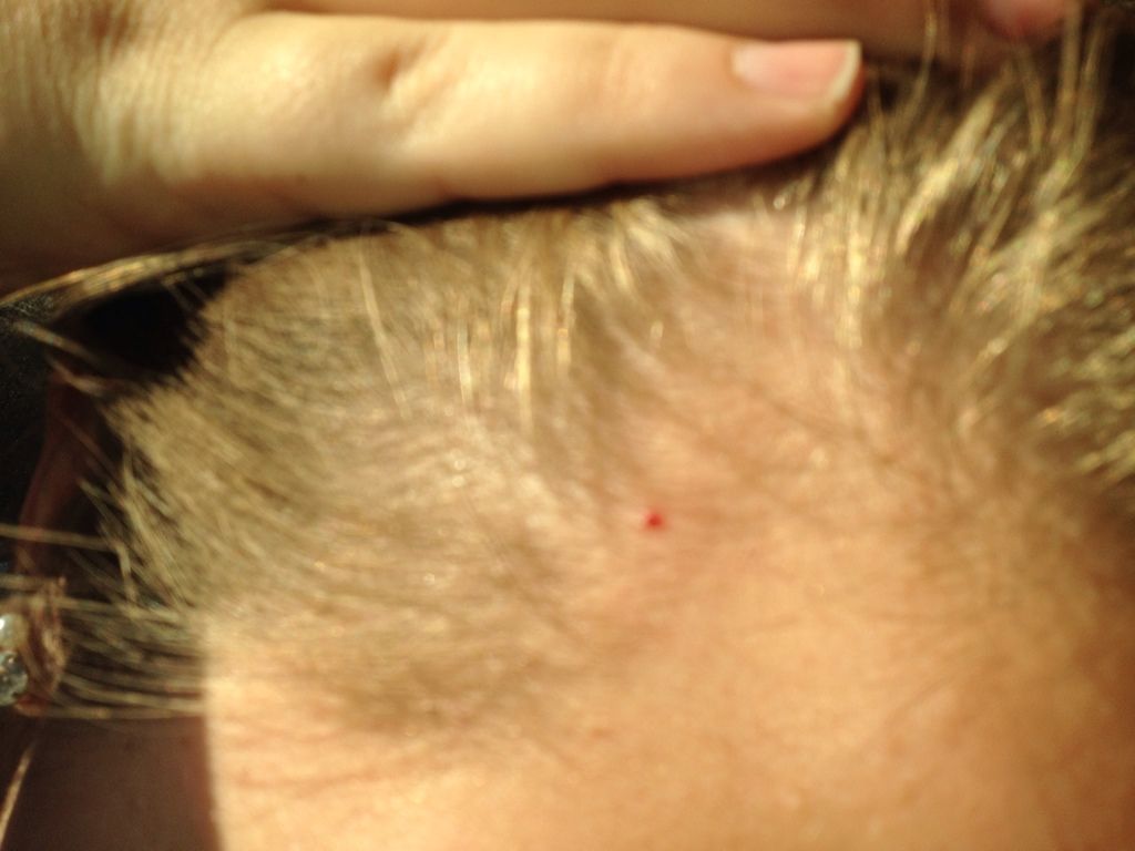 What Causes a Red, Itchy Scalp? | LIVESTRONG.COM